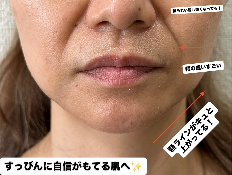 画像344