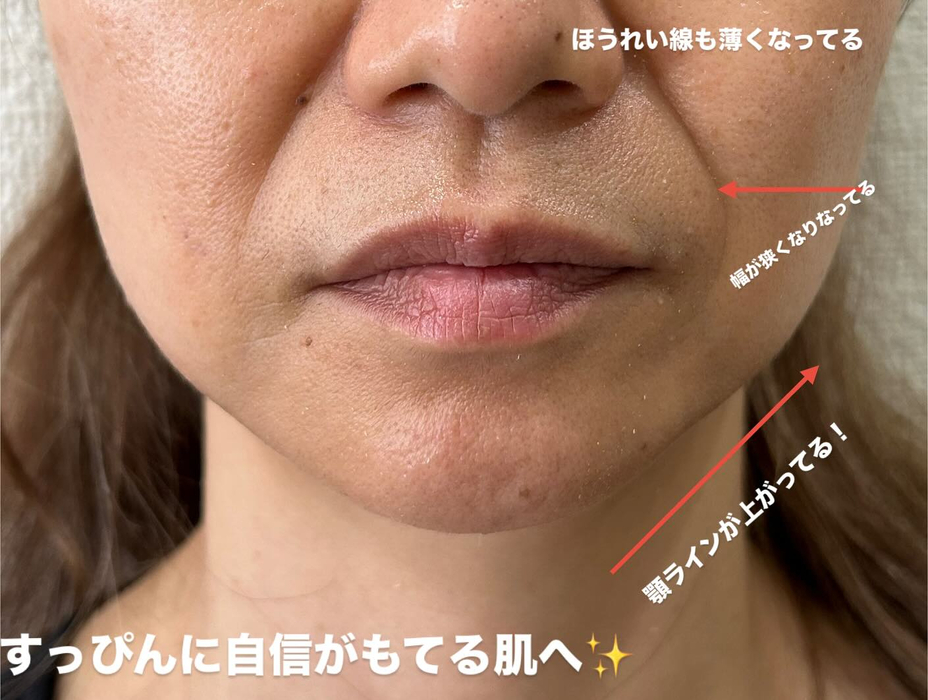 画像350