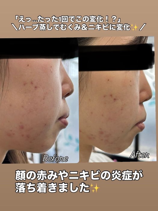 画像381